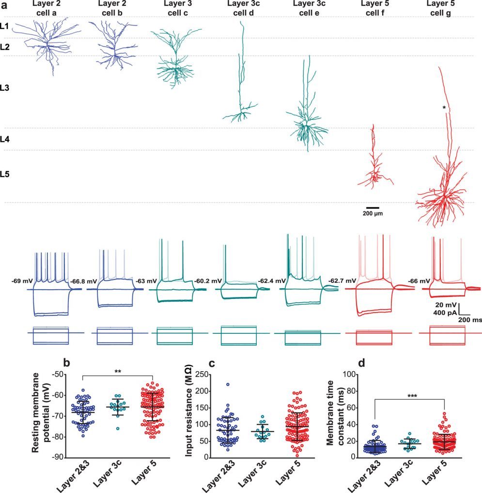 A figure from Moradi Chameh, Rich et. al., Nature Communciations 2021, showcasing the morphological and electrophysiological diversity of human cortical pyramidal neurons.
